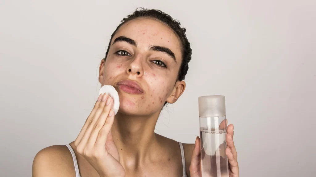 manchas na pele dermatologista manaus